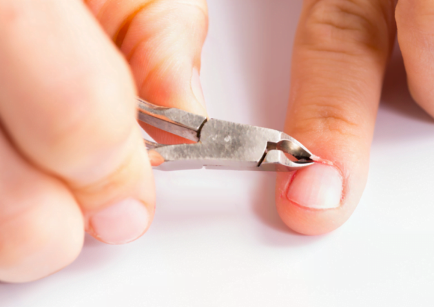 usuwanie-skórek-cążkami